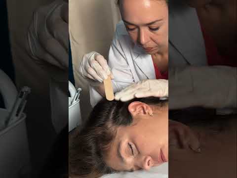 Asmr scalp tingles #asmr #asmrsounds #asmrvideo #relax #relaxing #satisfying #hair #sleep #tingles