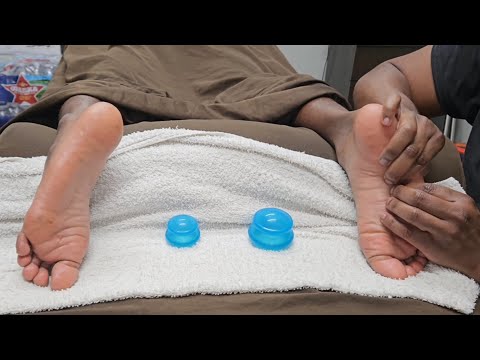 Model's Foot Cupping 