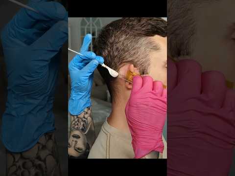 Behind the ear treatments