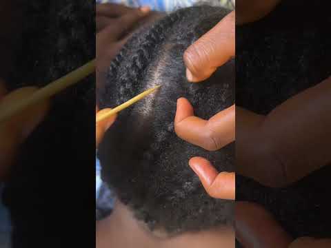 ASMR AGGRESSIVE SCALP SCRATCHING AND BRAIDS TAKE DOWN HEAD SCRATCHING FOR SLEEP