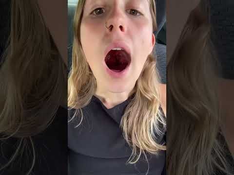 Would you like to inspect my tonsils for me?
