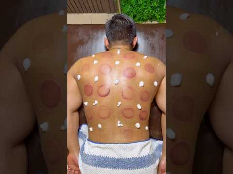 pizza peperoni😍🍕#pizza #cuppingtherapy #cupping #asmr #shorts #viral #explore