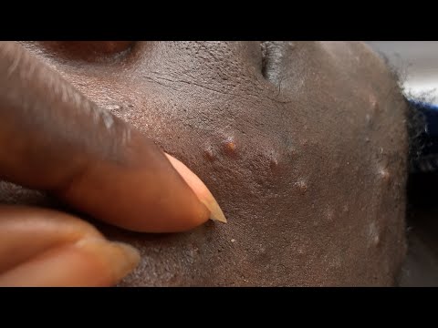 Asmr Face Nitpicking with a smooth hand Touching
