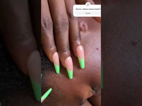 Asmr special face cleaning and nitpicking #asmrvideo