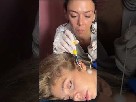 Asmr scalp tingles #asmr #asmrsounds #asmrvideo #relax #relaxing #satisfying #hair #sleep #tingles