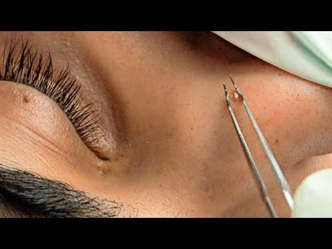 {ASMR} Super Attentive & Upclose FACE PICKING triggers 😴