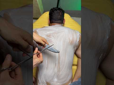 😍asmr cupping#asmr #shorts #cupping #cuppingtherapy #fire #asmrsounds