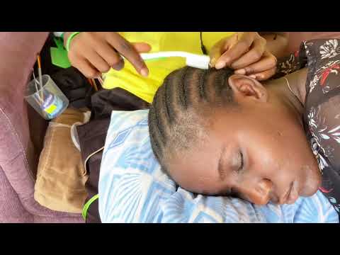 ASMR FACE NITPICKING AND SCALP SCRATCHING FOR SLEEP VERY SATISFYING