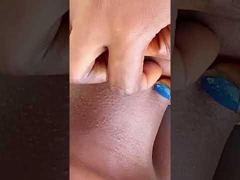 Face asmr to help you sleep #asmr #satisfying #nitpicking #cleaning