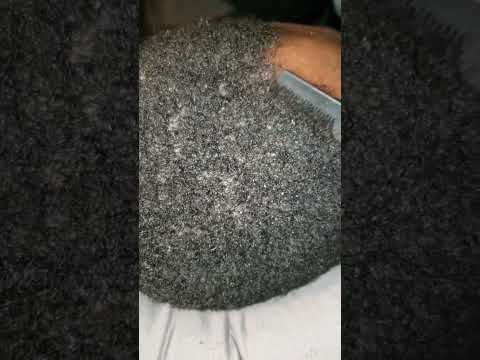 #asmr #asmrsounds #asmrvideo #scratching #scratching #sleep #flakes #peeling #hairstyle #haircare