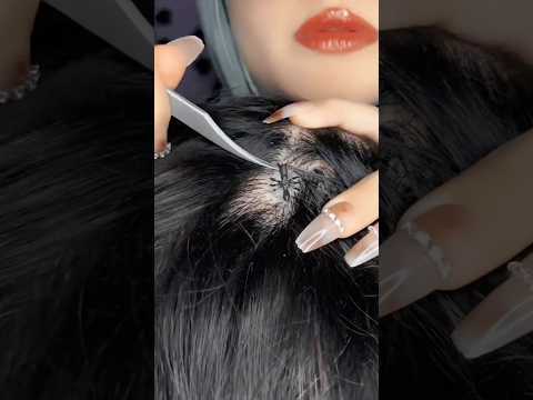 Bugs 🐜 #asmr #shorts #relax #hair #tingles