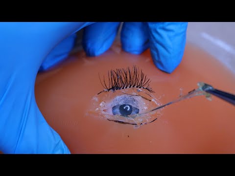 ASMR: CIRURGIA NO OLHO - SUPER SATISFATÓRIO • Sweet Carol