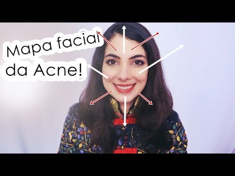 MAPA FACIAL DA ACNE!