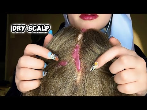ASMR Satisfying Dry Scalp Removing with Scalp Scratching 💆🏻‍♀️