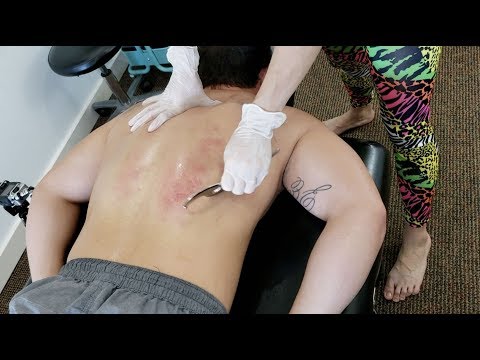 Powerlifter Injures Low Back Performing Deadlift Mondragon, DC