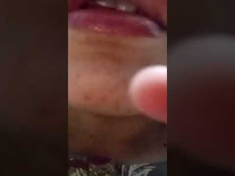 Asmr mouthsounds full video on YouTube:https: //youtu.be/cVoglt0lLMg