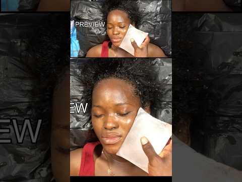 ASMR💫 Aggressive Hair scalp scratch massage | face massage with ice block & jade roller