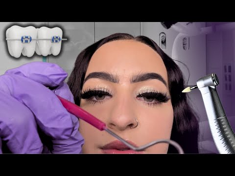 [ASMR] Fixing Your Braces Bracket & Clipping Wire 🔧 | Soft Spoken