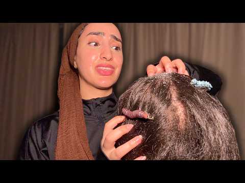 ASMR for People with Nits and Head Lice 🐛 (Fast and Aggressive Scalp Scratching)