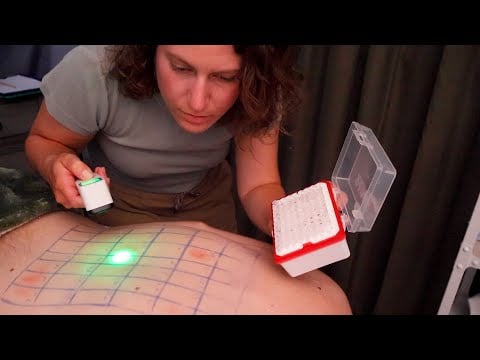 [ASMR] Allergy Test and Skin Treatment Exam for Sleep