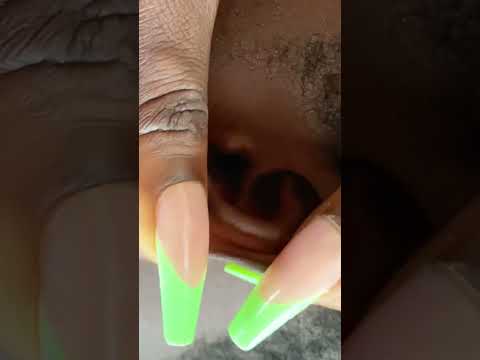 Asmr Super Attentive deep ear cleaning #asmr #tingling #satisfying  #earcleaning