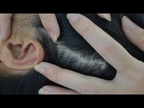 ASMR Scalp Scratching Aggressive, Nape & Shoulder Attention For Deep Sleep ( Asmr No Talking )