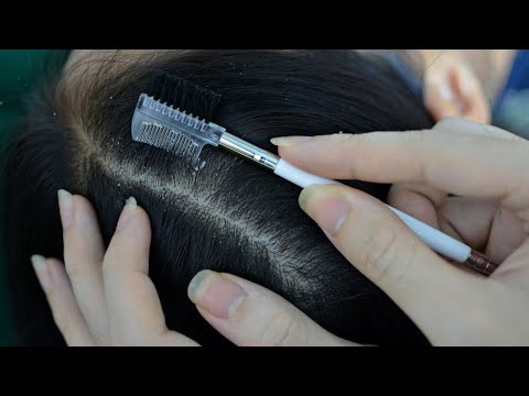 ASMR Scalp Scratching Aggressive On Real Person For Better Insomnia ( No Talking )