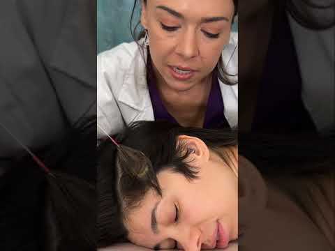 Asmr scalp tingles #asmr #asmrsounds #asmrvideo #relax #relaxing #satisfying #hair #sleep #tingles