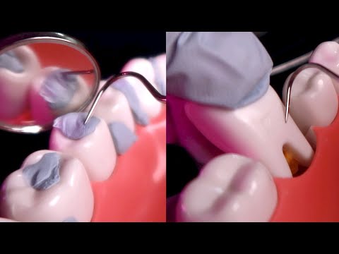 ASMR🦷 1 Hour of Teeth Scaling⎢ Deep Dental Cleaning  ⎢ Dental Pick (No Talking)