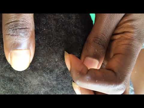 Asmr scratching and massaging of hair and scalp, Nitpicking #asmr #satisfying