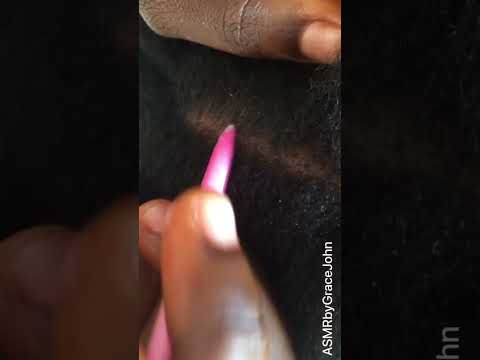 Asmr / Great Scalp Scratch By My Friend. #scalpscratching #amsrtriggers #triggers