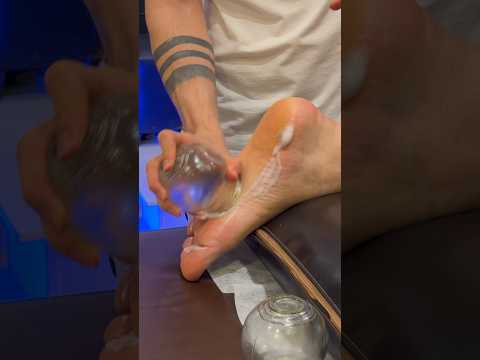 Have you tried it yet?😍❤️#shorts #cupping #relax #explore #asmr