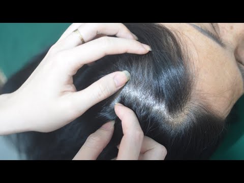 ASMR Real Person Head Scratching And Tingling Hair Sounds For Reduce Stress, Anxiety