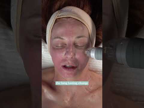 How to Fix Aging Skin