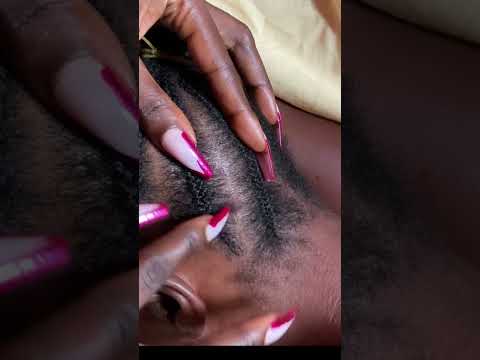 aggressive scalp scratching asmr real person #asmr #dandruff #scratch #scalpcheck #braids