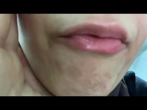 20 minute sleep 😴😴😴 Spit painting asmr Mouth asmr #asmrsounds #asmr #asmrvideo #spitpainting