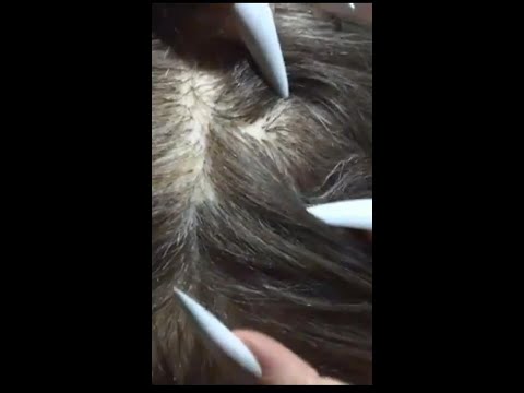 ASMR Sleep Inducing Scalp Check with Long Nails #shorts