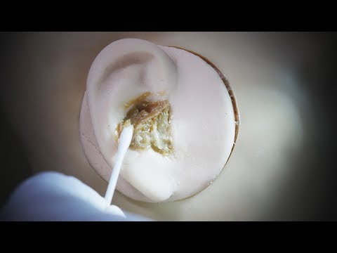 ASMR Your ears are full of earwax 10 – Sugar Scrub / Ear Cleaning (No Talking)