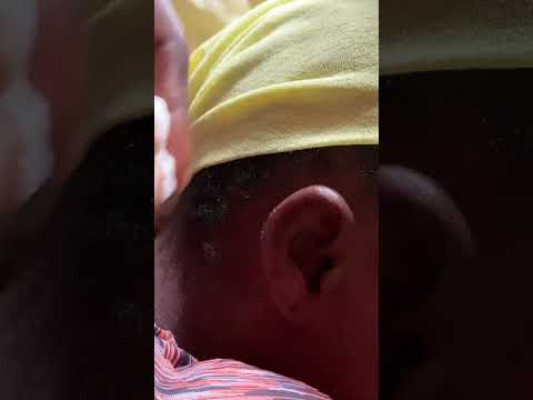 ASMR EAR HOLE PICKING &CLEANING #asmr #earcleaning #nitpicking