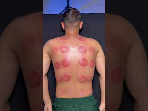 😍🍕#shorts #viral #fyp #viralshorts #trendingshorts #cupping #explore