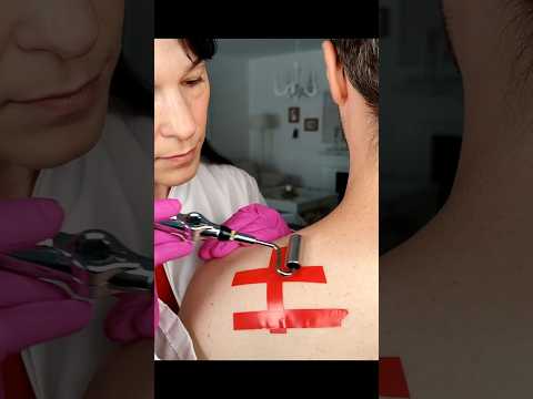Skin allergy test and analysis