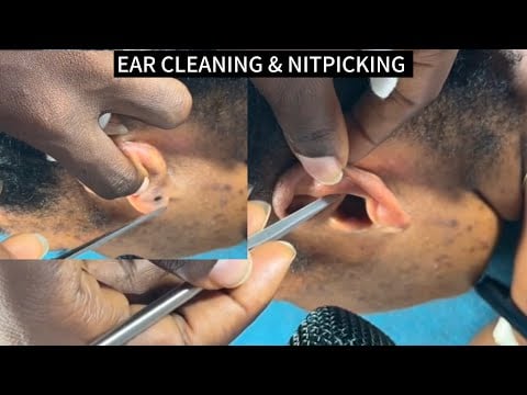 ASMR Ear Cleanings and nitpicking , Scalp Scratching & Back Scratching for Sleep 😴 Intense Tingles