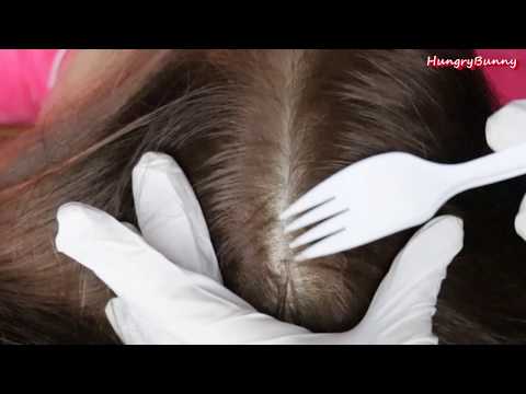 ASMR Scalp Scratch Relaxing Sounds 頭皮の傷つき音  Dandruff Scratching