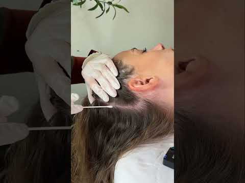 Asmr scalp tingles #asmr #asmrsounds #asmrvideo #relax #relaxing #satisfying #hair #sleep #tingles