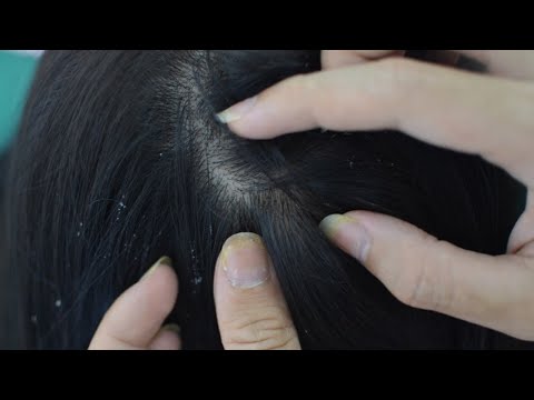 ASMR Scalp Scratching, Hair Scratching, Hair Brushing For People Insomnia, Stress