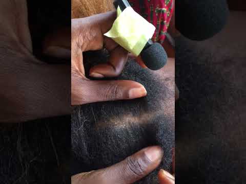 Asmr Scalp scratching. #amsrtriggers #asmr #dandruff #asmrsound