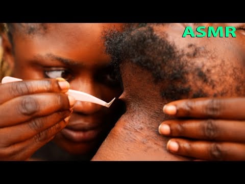 ASMR✨Let me be your therapist, deep ear cleaning, ingrown hair pulling, scalp scratching massage 