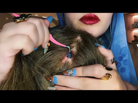 ASMR 🐜 Scalp Exam: Scratching & Bug Check 🔍 (So Relaxing)