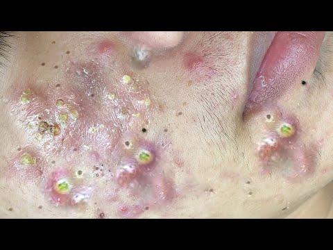 حلول طبيعية لبشرة صافية# 𝐒𝐤𝐢𝐧 𝐂𝐚𝐫𝐞 56635