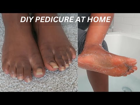 Snip Snap ✂️✂️ Pedicure At Home *FEET TRANSFORMATION* | SELF PAMPERING